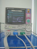 生体心電図モニター